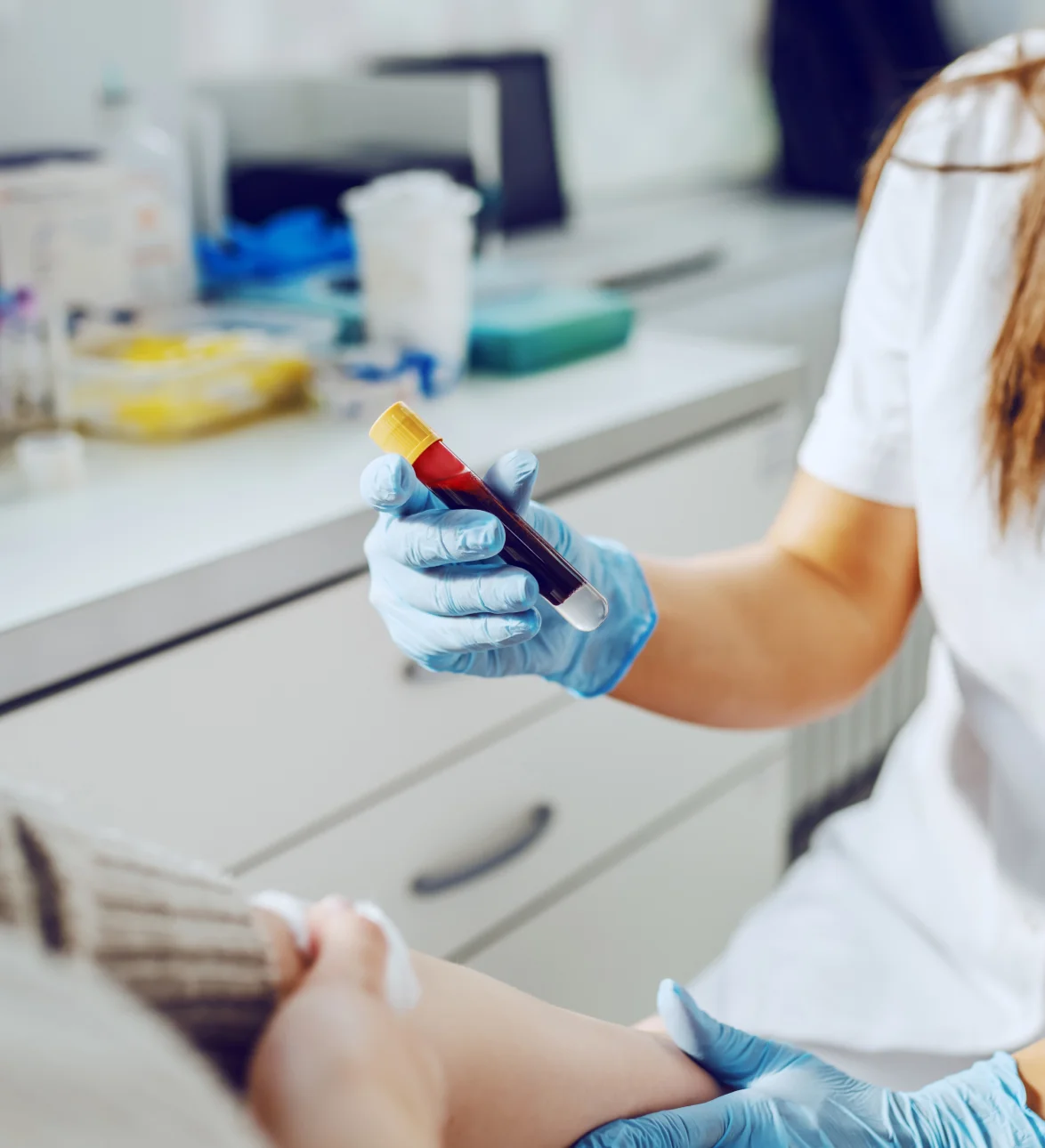 HIV Screening