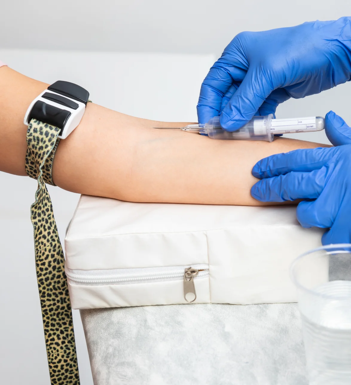 HBV Screening
